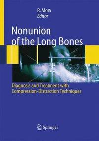 bokomslag Nonunion of the Long Bones