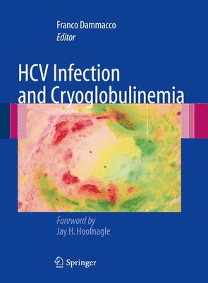 HCV Infection and Cryoglobulinemia 1