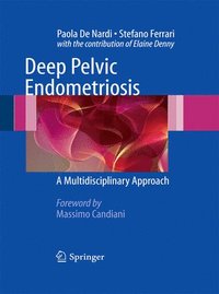 bokomslag Deep Pelvic Endometriosis