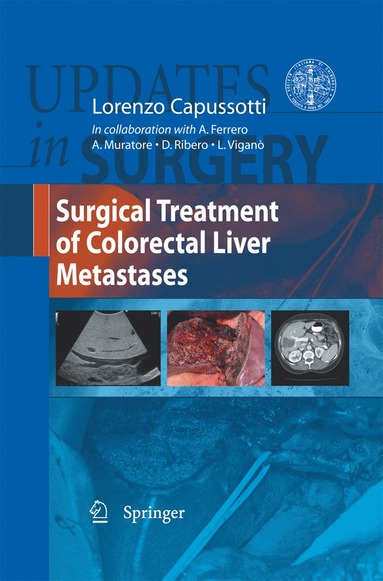 bokomslag Surgical Treatment of Colorectal Liver Metastases