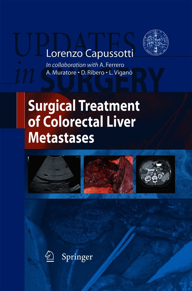 Surgical Treatment of Colorectal Liver Metastases