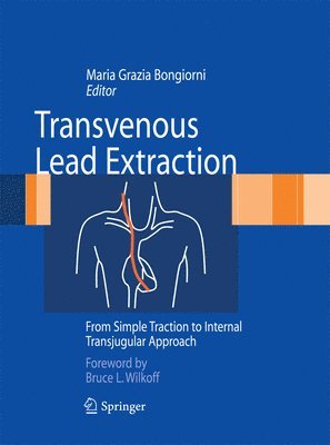 Maria Grazia Bongiorni - Transvenous Lead Extraction, Häftad