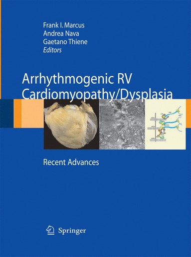 bokomslag Arrhythmogenic RV Cardiomyopathy/Dysplasia