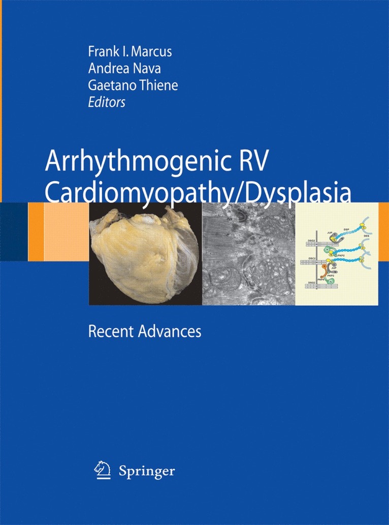 Frank I. Marcus, Andrea Nava, Gaetano Thiene - Arrhythmogenic RV Cardiomyopathy/Dysplasia, Häftad