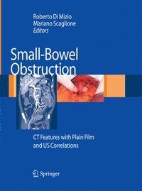 bokomslag Small-Bowel Obstruction