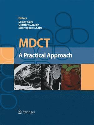 MDCT: A Practical Approach 1