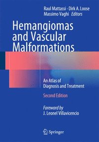 bokomslag Hemangiomas and Vascular Malformations