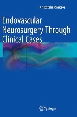 Endovascular Neurosurgery Through Clinical Cases 1