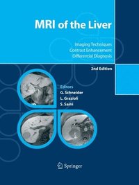 bokomslag MRI of the Liver