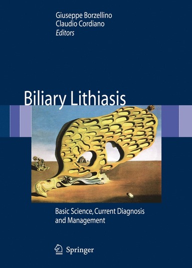 bokomslag Biliary Lithiasis