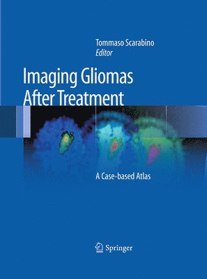 bokomslag Imaging Gliomas After Treatment