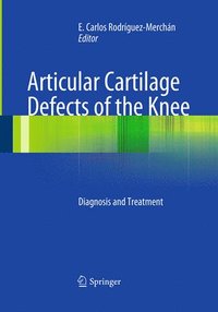bokomslag Articular Cartilage Defects of the Knee