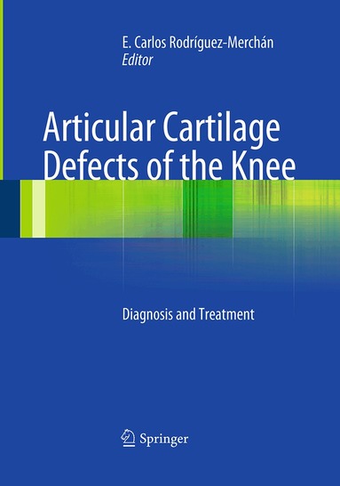 E. Carlos Rodrìguez-Merchán - Articular Cartilage Defects of the Knee, Häftad