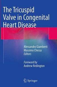 bokomslag The Tricuspid Valve in Congenital Heart Disease