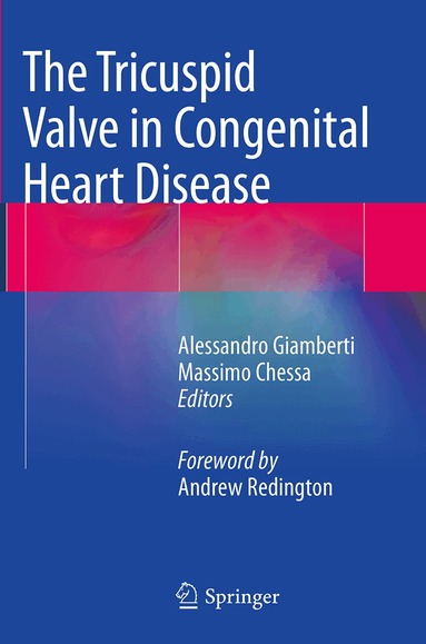 Alessandro Giamberti, Massimo Chessa - Tricuspid Valve in Congenital Heart Disease, Häftad