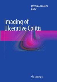 bokomslag Imaging of Ulcerative Colitis