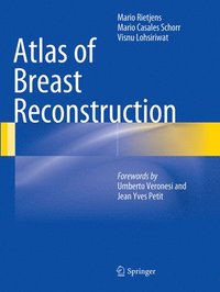 bokomslag Atlas of Breast Reconstruction