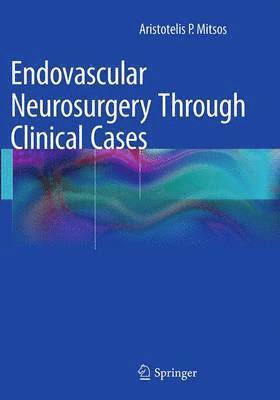 bokomslag Endovascular Neurosurgery Through Clinical Cases