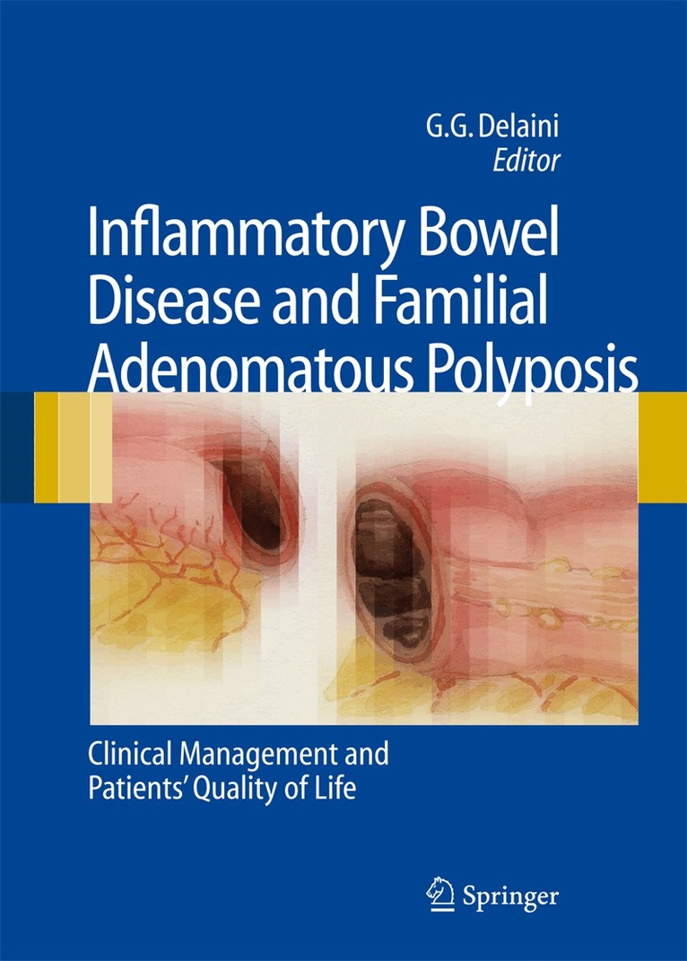 Gian Gaetano Delaini - Inflammatory Bowel Disease and Familial Adenomatous Polyposis, Häftad
