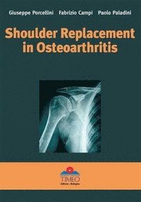 bokomslag Shoulder Replacement in Osteoarthritis