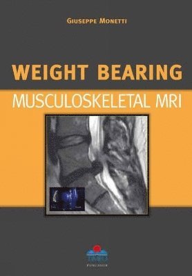 Weight Bearing Musculoskeletal MRI 1