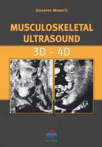 bokomslag Musculoskeletal Ultrasound 3D-4D