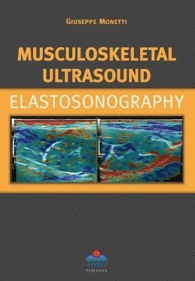 Musculoskeletal Ultrasound Elastosonography 1