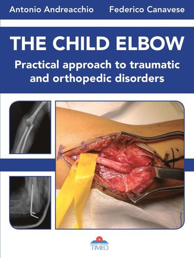 bokomslag Child Elbow