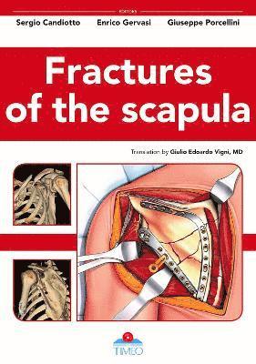 bokomslag Fractures of the Scapula