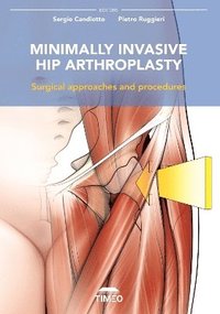 bokomslag Minimally Invasive Hip Arthroplasty