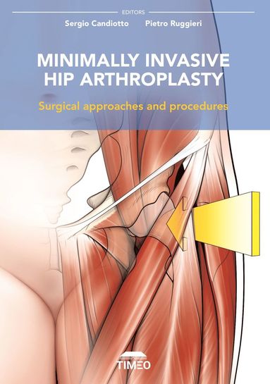 bokomslag Minimally Invasive Hip Arthroplasty