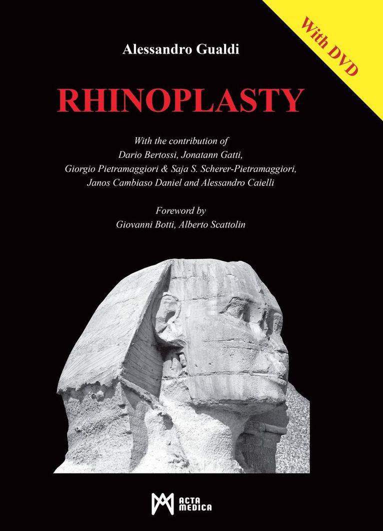 Rhinoplasty 1