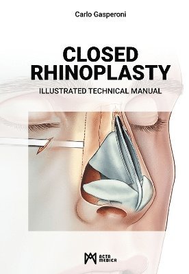 Closed Rhinoplasty 1