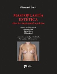 bokomslag Mastoplasta Esttica