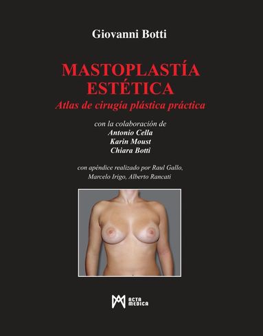 bokomslag Mastoplastía Estética