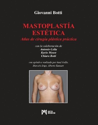Mastoplasta Esttica 1