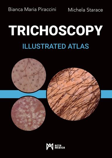 Bianca Maria Piraccini, Michela Starace - Trichoscopy, Inbunden