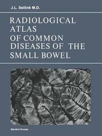 bokomslag Radiological Atlas of Common Diseases of the Small Bowel