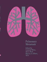 bokomslag Pulmonary Metastasis