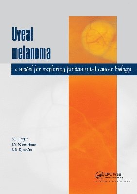 Uveal Melanoma 1