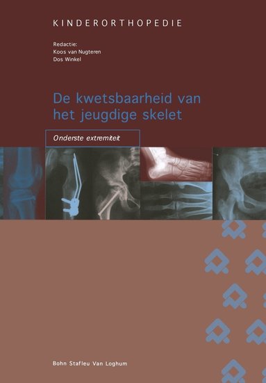 bokomslag de Kwetsbaarheid Van Het Jeugdige Skelet: Onderste Extremiteit