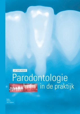 bokomslag Parodontologie in de Praktijk