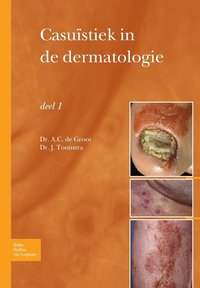 bokomslag Casustiek in de Dermatologie - Deel I