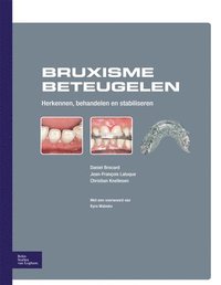 bokomslag Bruxisme Beteugelen: Herkennen, Behandelen En Stabiliseren