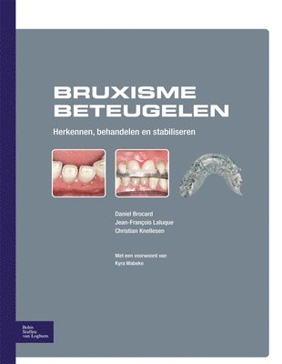bokomslag Bruxisme Beteugelen: Herkennen, Behandelen En Stabiliseren