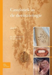 bokomslag Casustiek in de Dermatologie - Deel 2