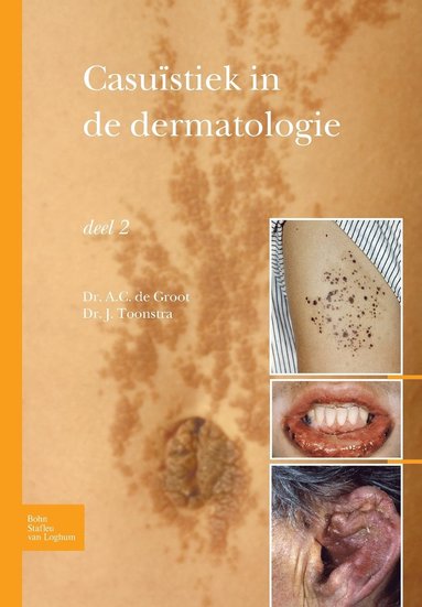 bokomslag Casuïstiek in de Dermatologie - Deel 2