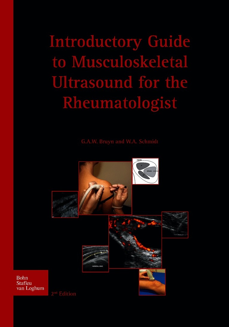 Introductory guide to musculoskeletal ultrasound for the rheumatologist