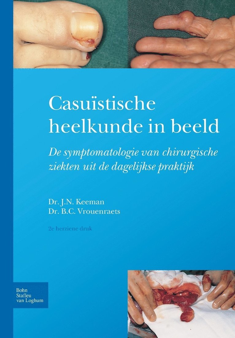 J N Keeman, Bart Cornelius Vrouenraets, J. N. Keeman, J.N. Keeman - Casuïstische Heelkunde in Beeld, Häftad