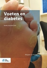bokomslag Voeten En Diabetes